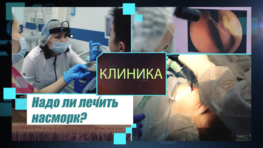 Надо ли лечить насморк?